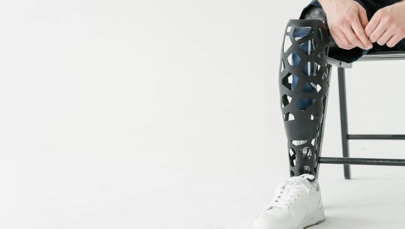 “La Chatarra Camina” una iniciativa donde por medio del reciclaje se crean prótesis gratuitas